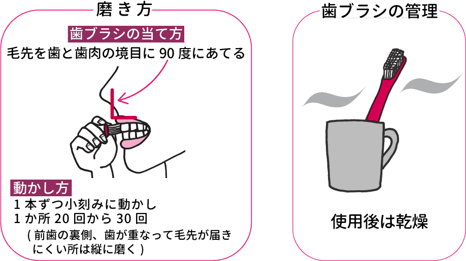 歯ブラシの大きさ、持ち方、磨き方、管理