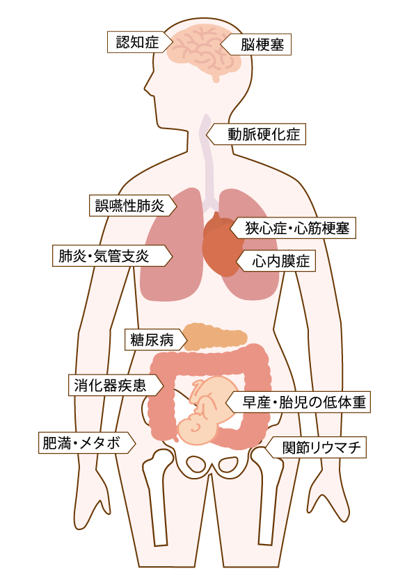 歯周病と全身疾患