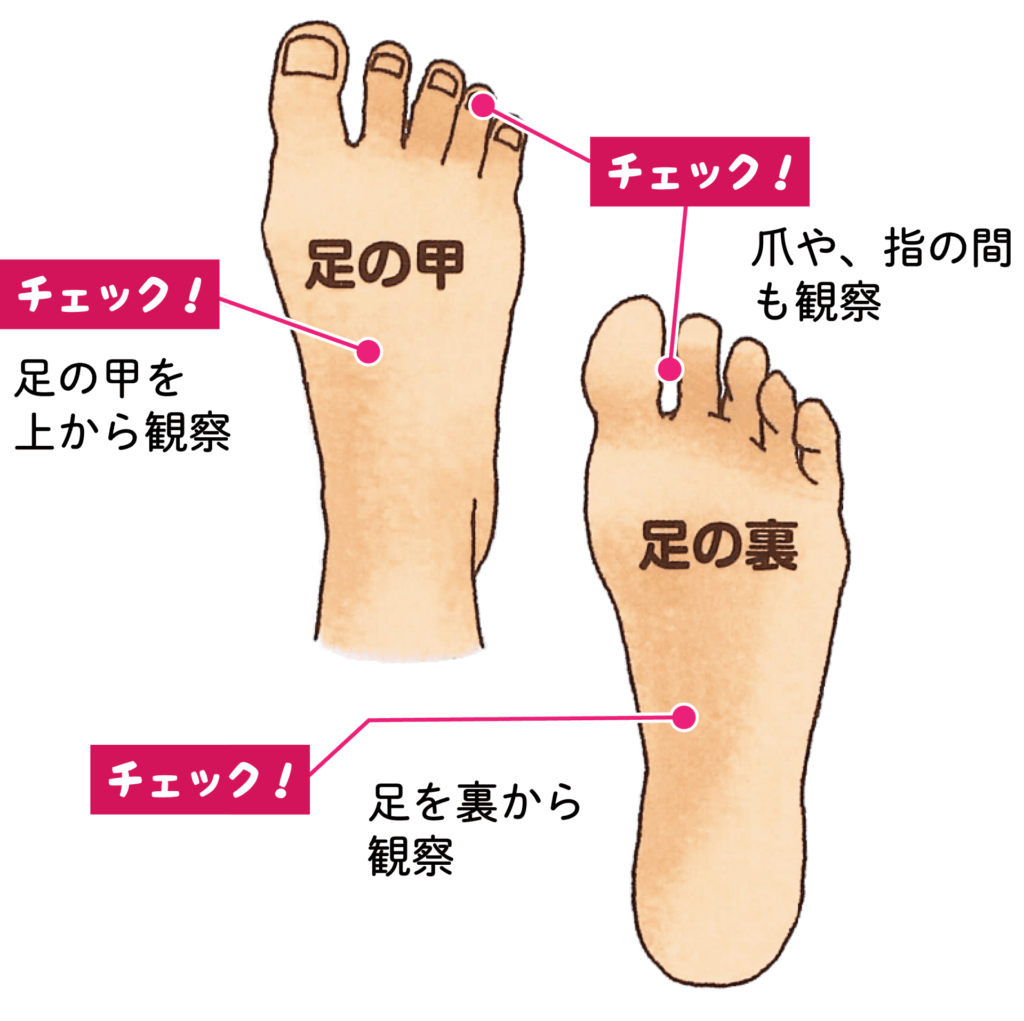 足の甲や足の裏をチェック