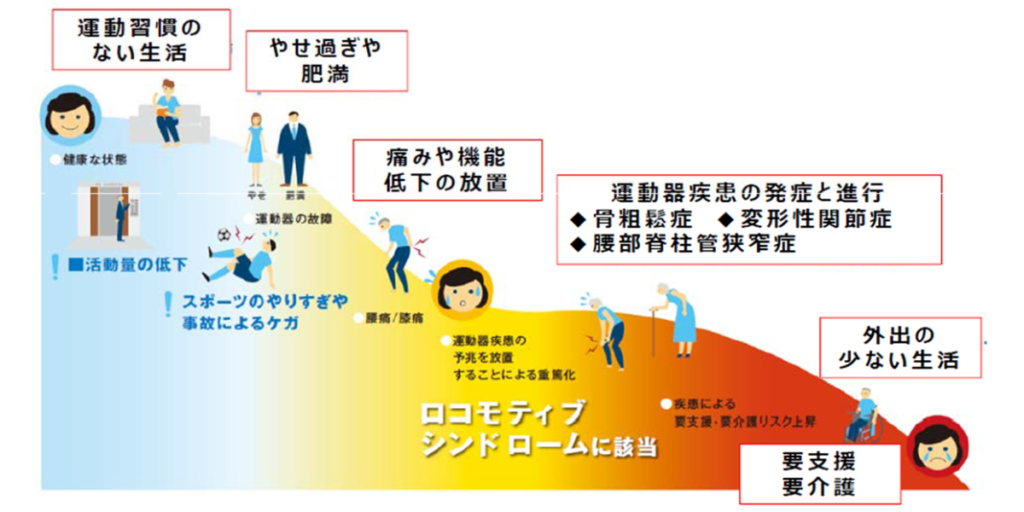 ロコモティブシンドロームの進行